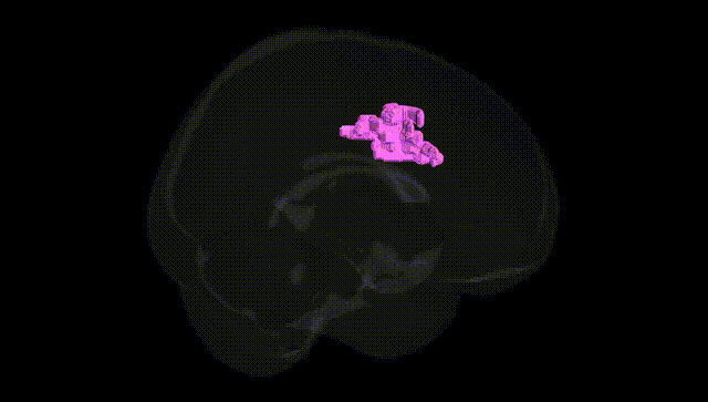 Full Brain Black
