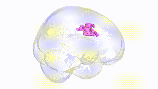 Full Brain White