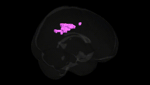 Full Brain Black