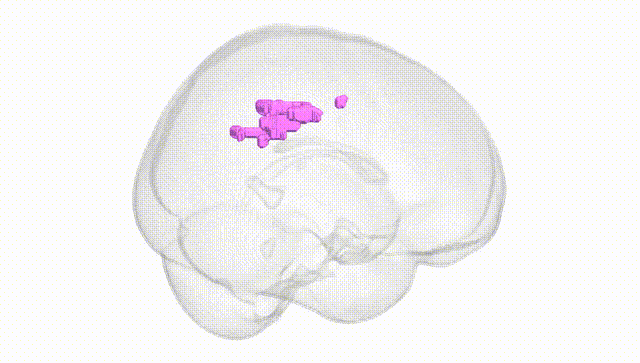 Full Brain White