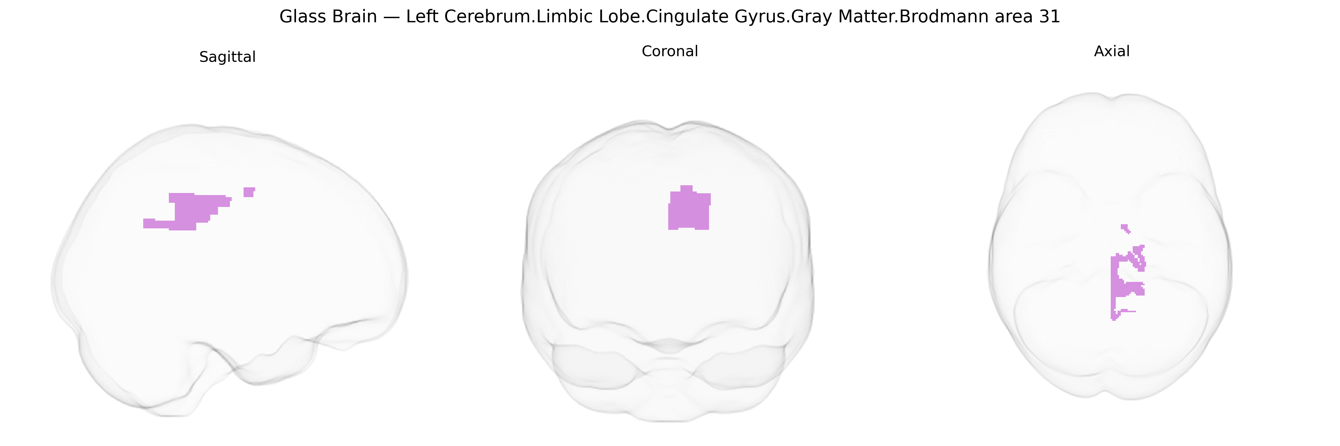 Triplanar Ghost Brain