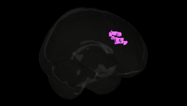 Full Brain Black
