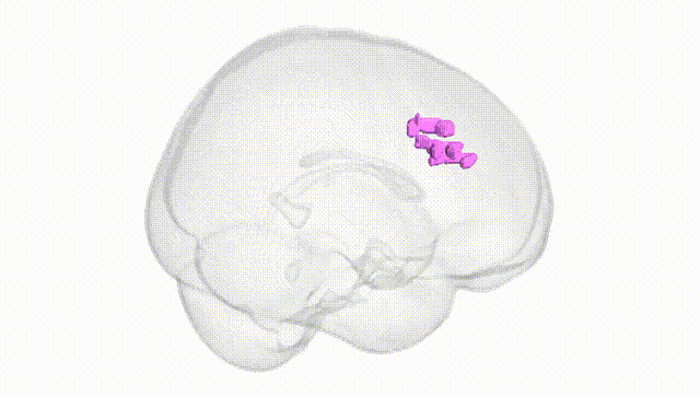 Full Brain White