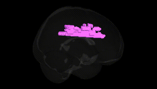 Full Brain Black