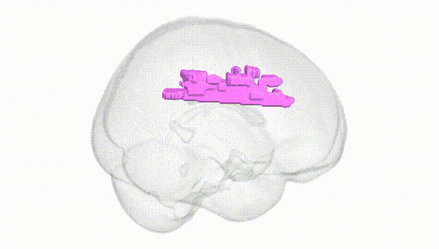 Full Brain White