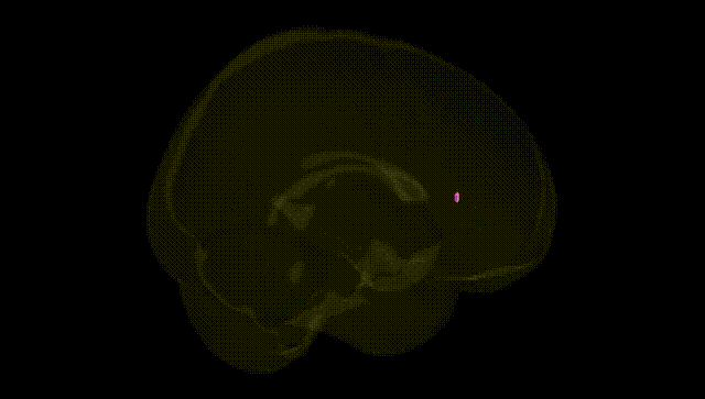 Full Brain Black