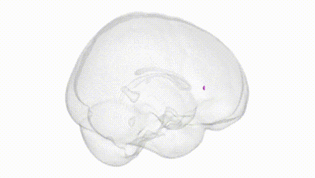 Full Brain White