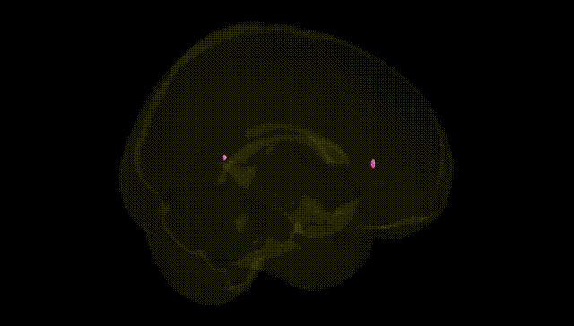 Full Brain Black