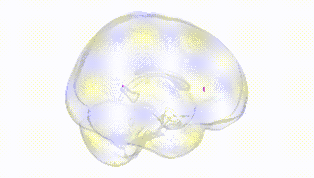Full Brain White