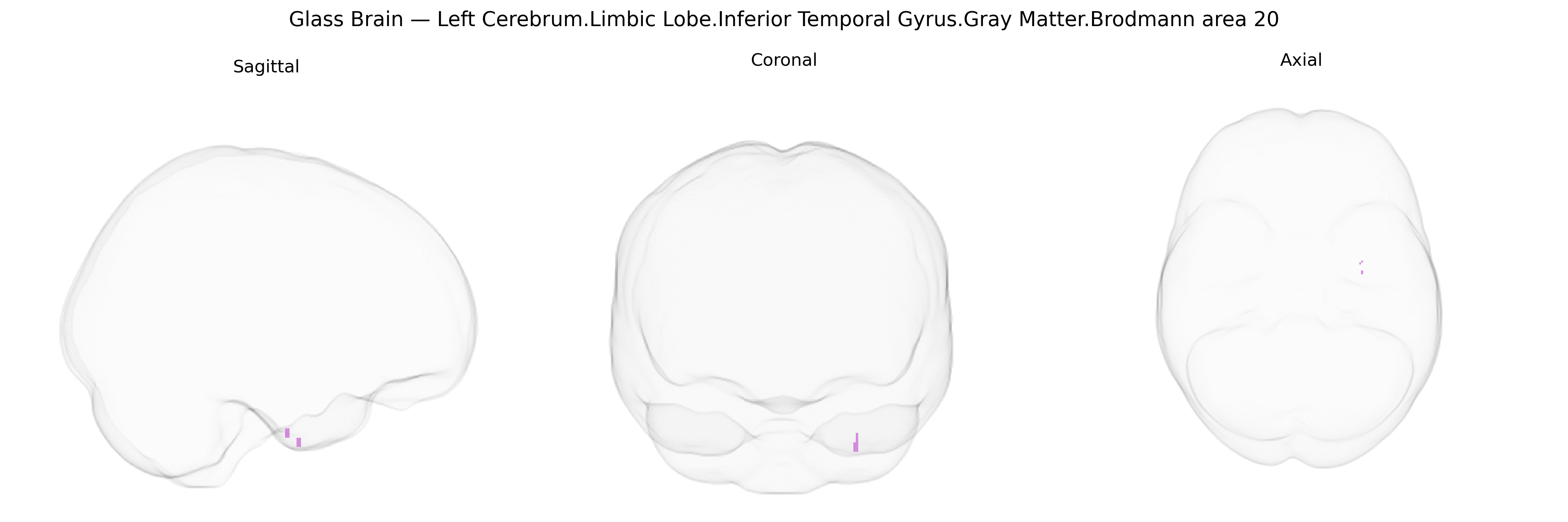 Triplanar Ghost Brain