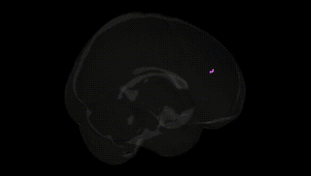 Full Brain Black