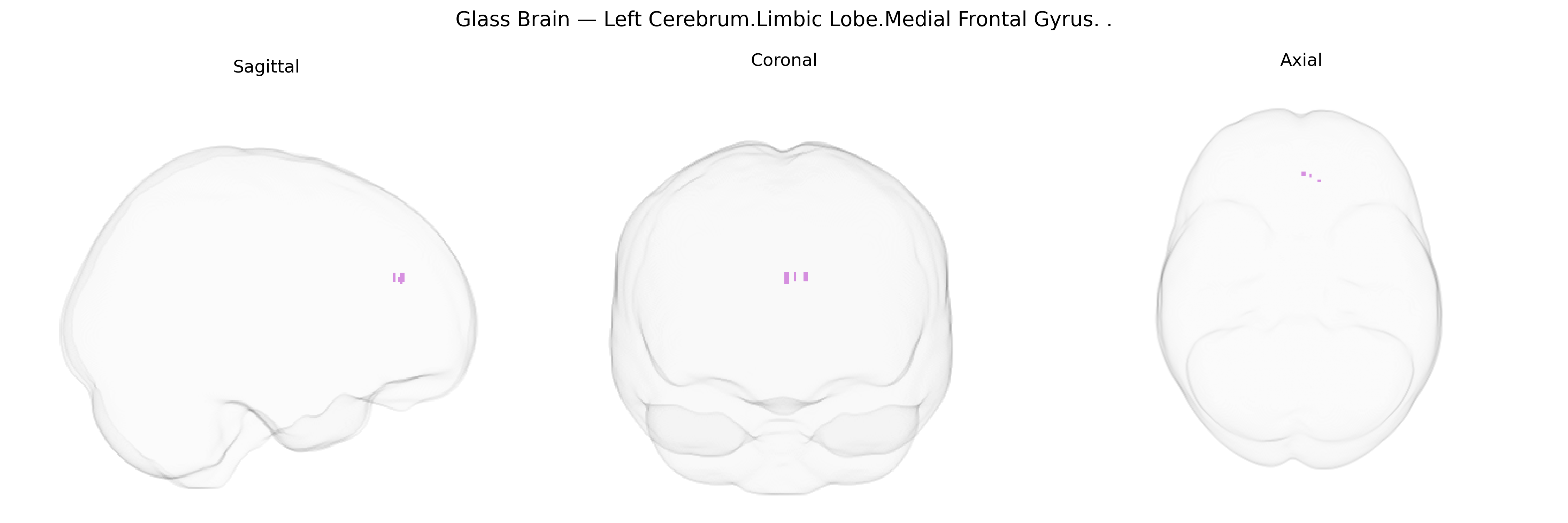 Triplanar Ghost Brain