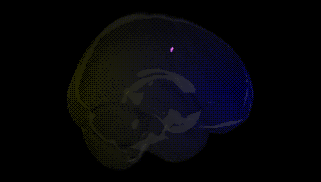 Full Brain Black
