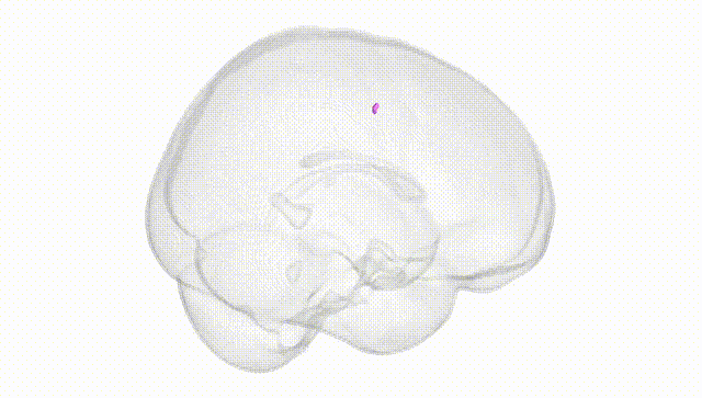 Full Brain White