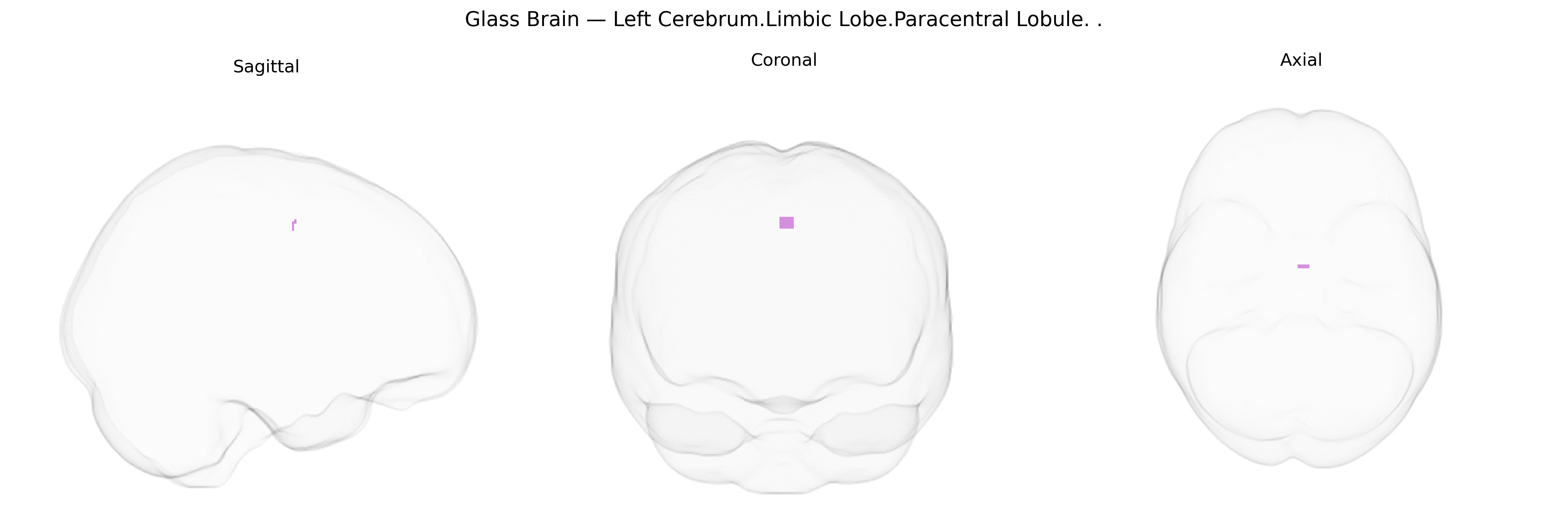 Triplanar Ghost Brain
