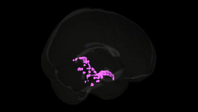 Full Brain Black