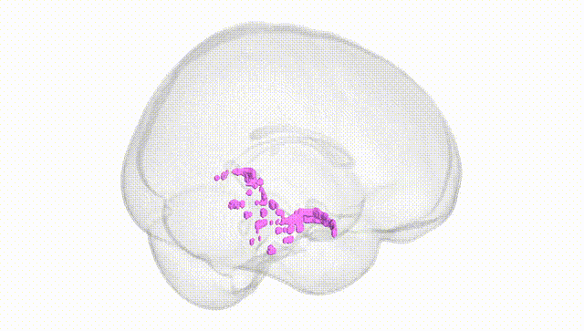 Full Brain White