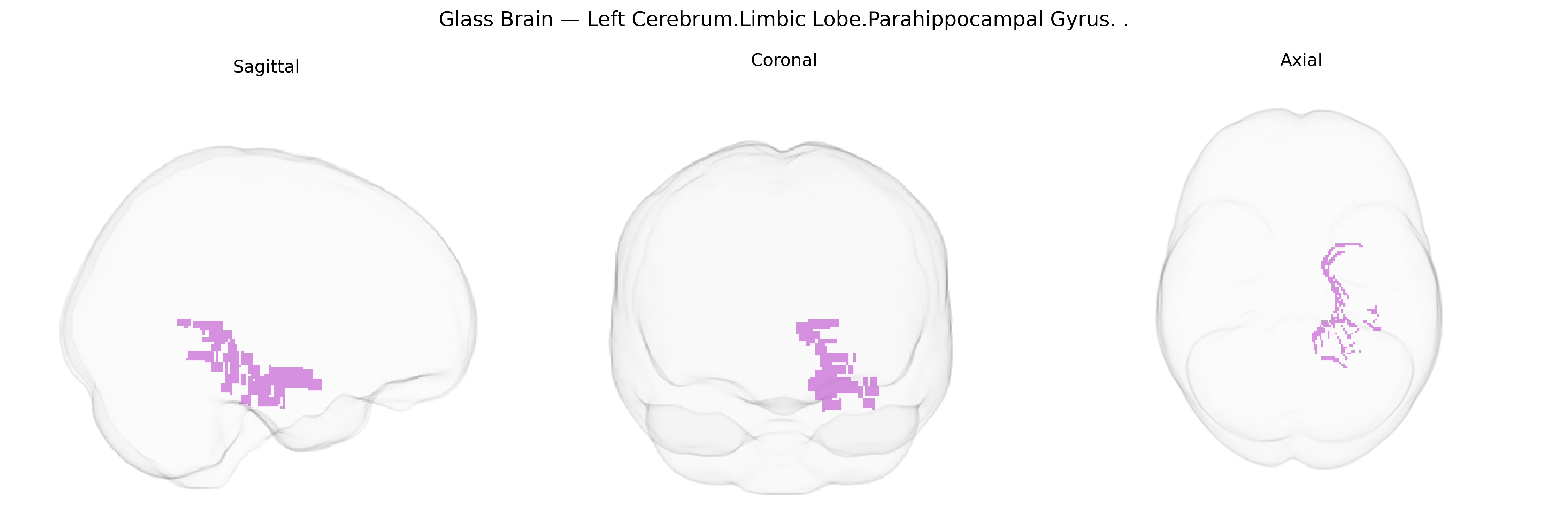 Triplanar Ghost Brain