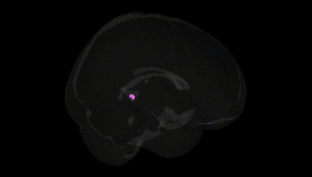 Full Brain Black