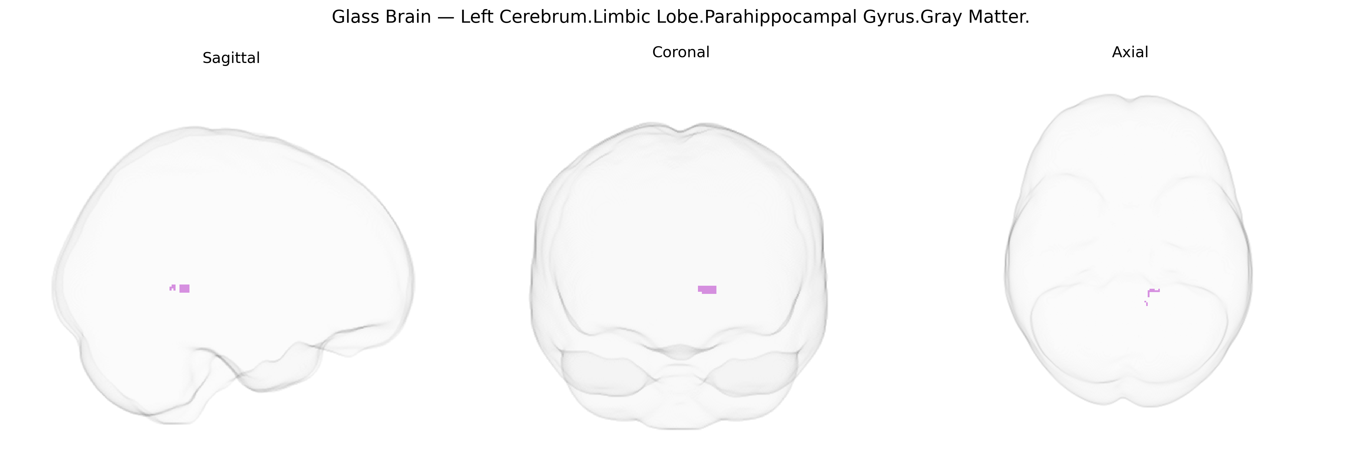 Triplanar Ghost Brain