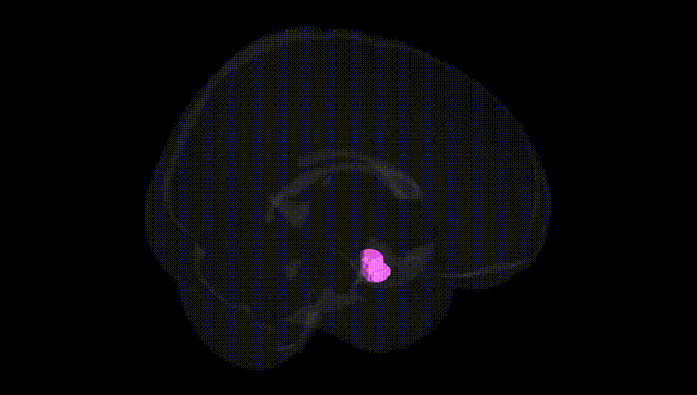 Full Brain Black