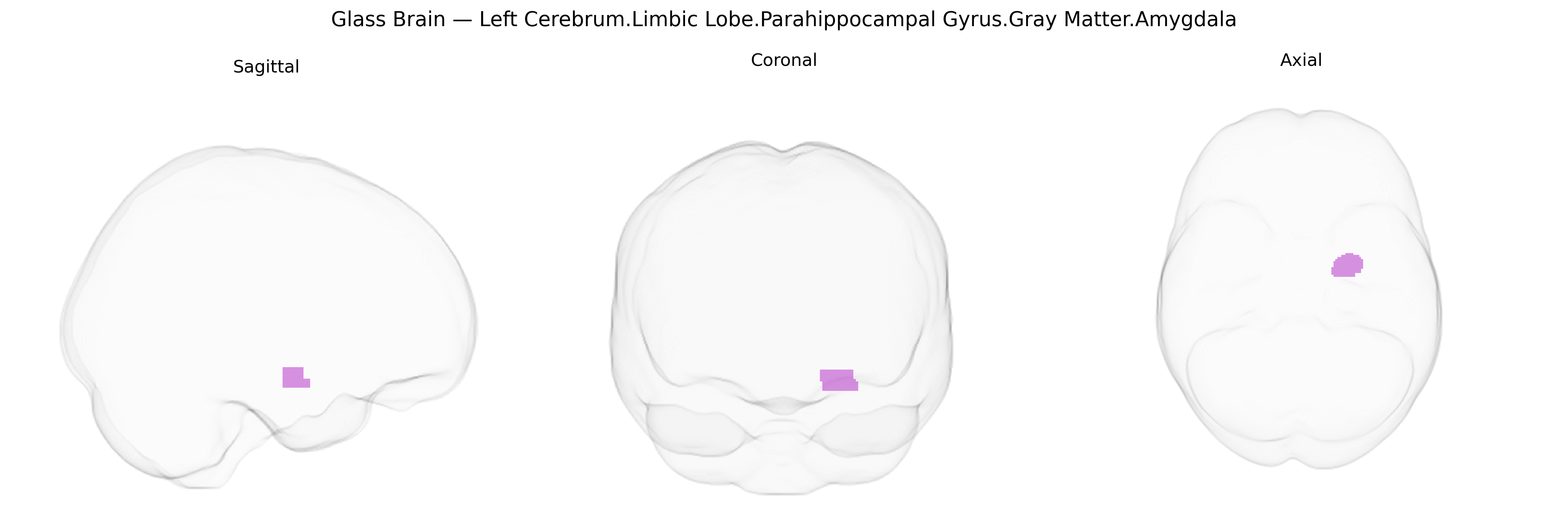 Triplanar Ghost Brain