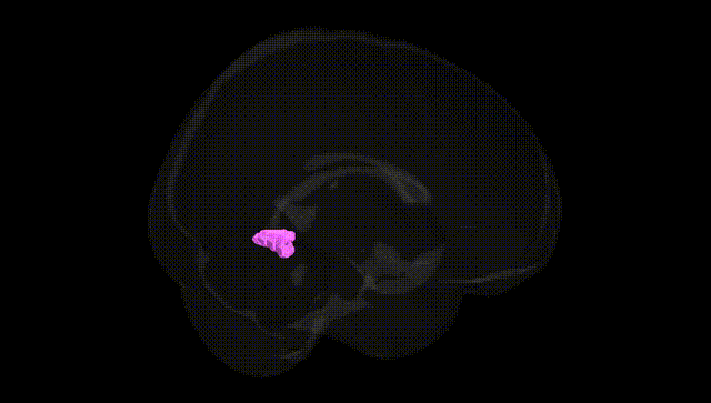 Full Brain Black
