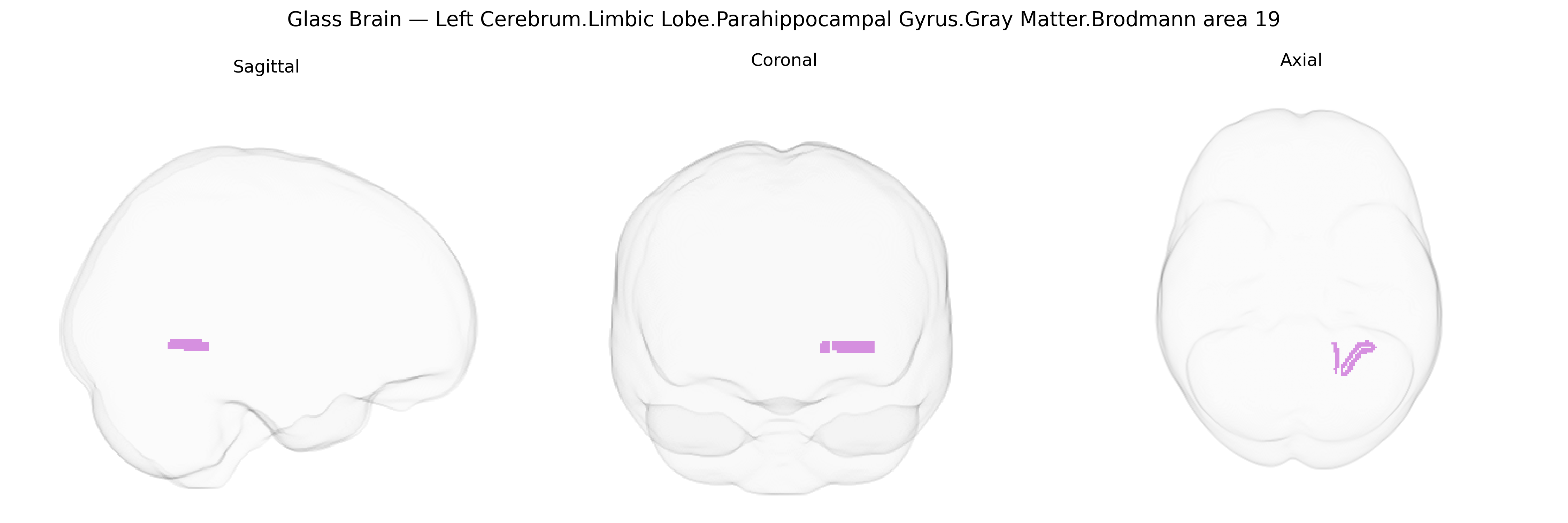 Triplanar Ghost Brain