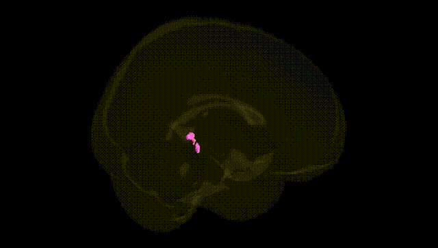 Full Brain Black