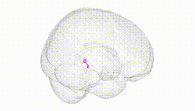 Full Brain White
