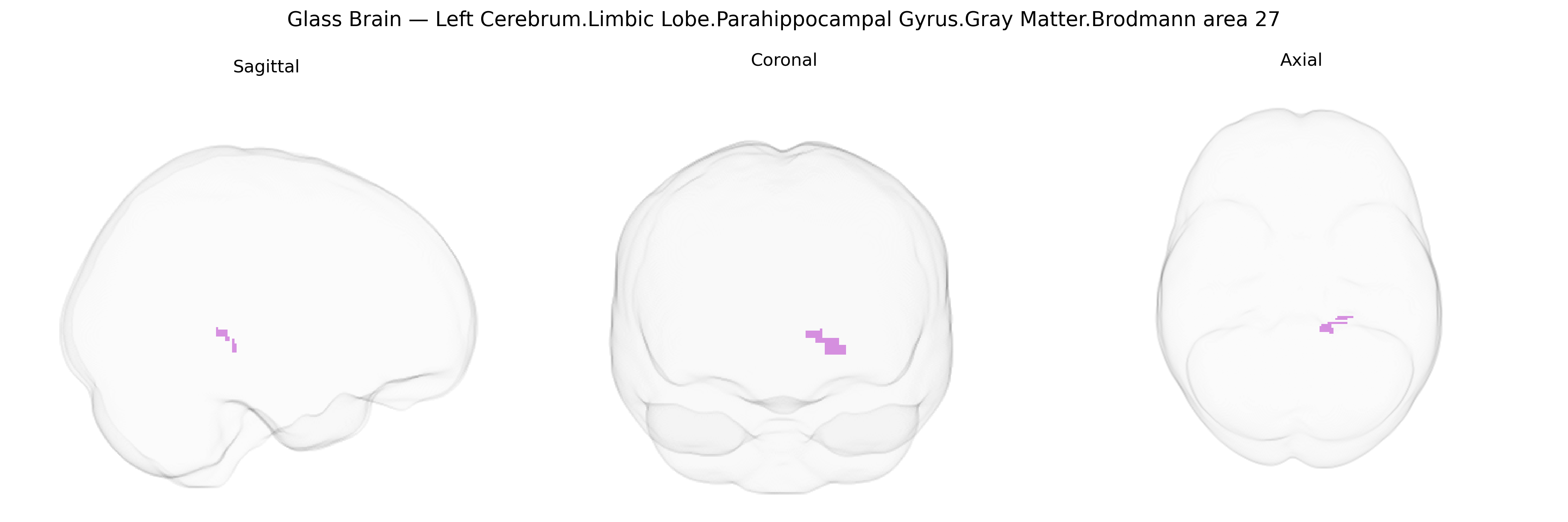 Triplanar Ghost Brain