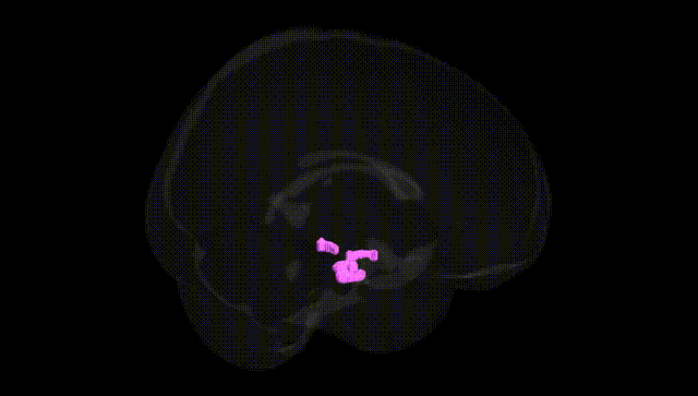 Full Brain Black