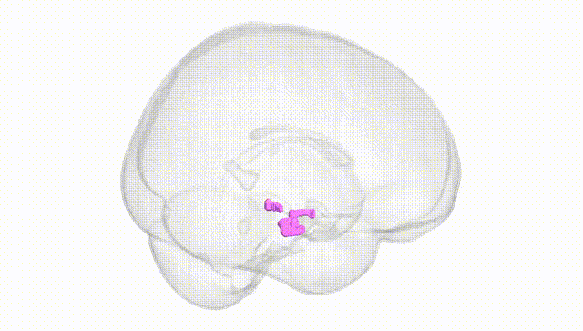 Full Brain White