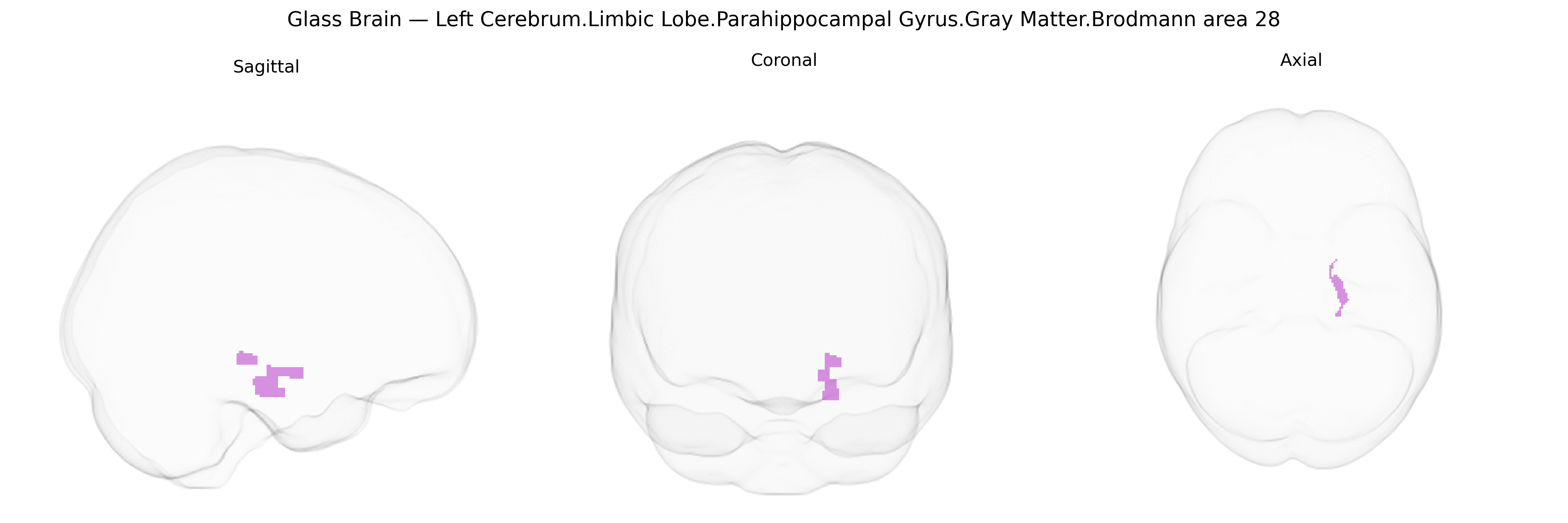 Triplanar Ghost Brain