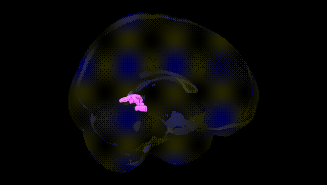 Full Brain Black