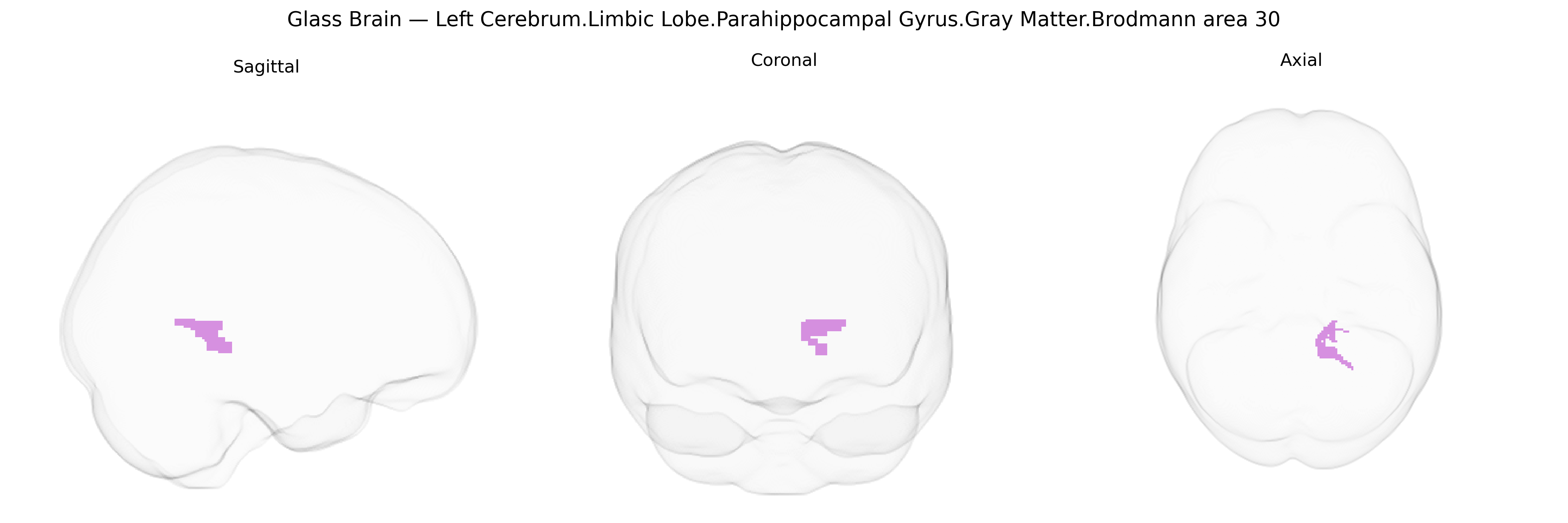 Triplanar Ghost Brain