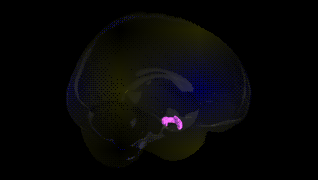 Full Brain Black