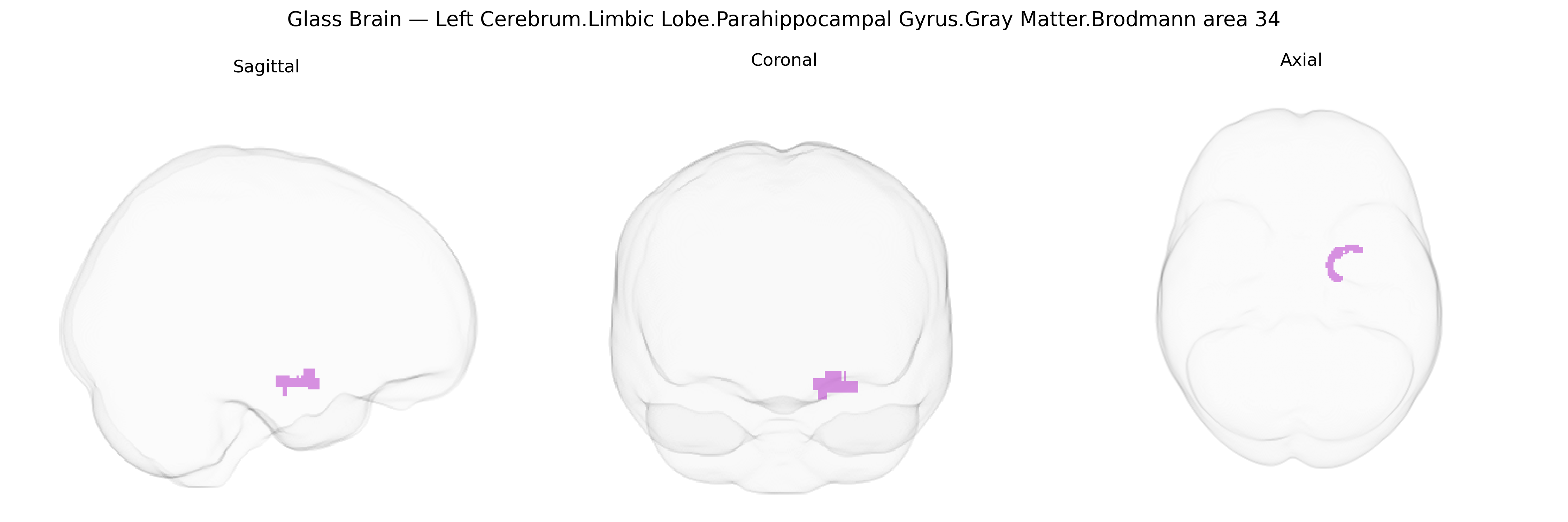 Triplanar Ghost Brain