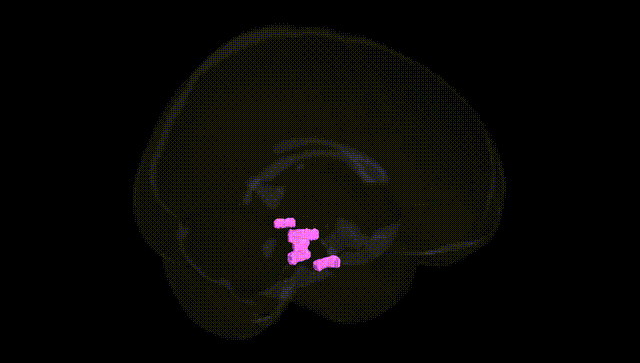 Full Brain Black