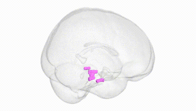 Full Brain White