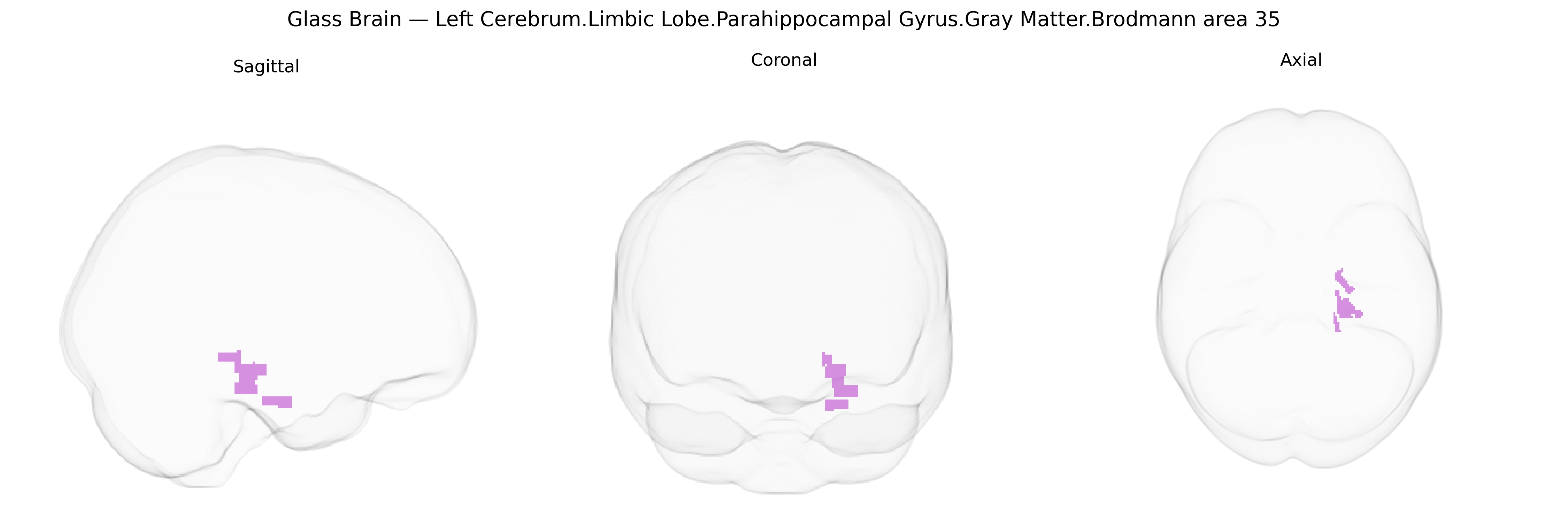 Triplanar Ghost Brain