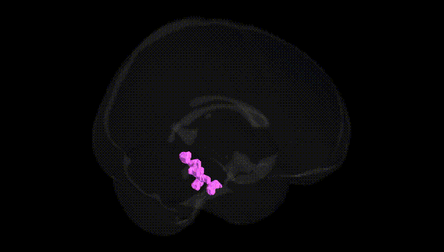 Full Brain Black