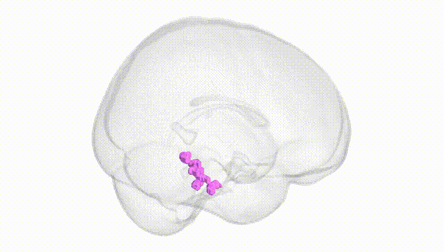 Full Brain White