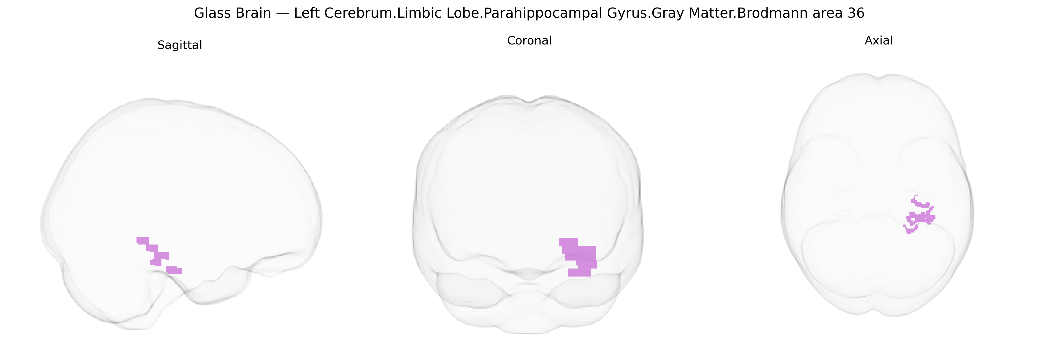 Triplanar Ghost Brain