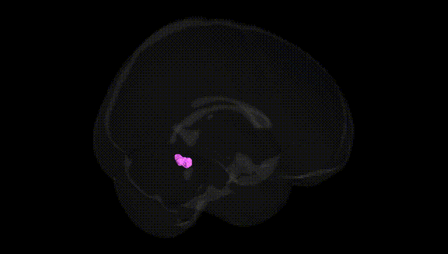 Full Brain Black