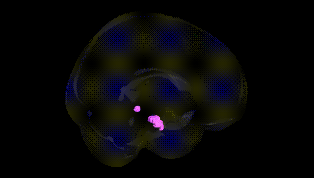 Full Brain Black