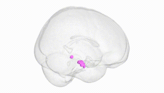 Full Brain White