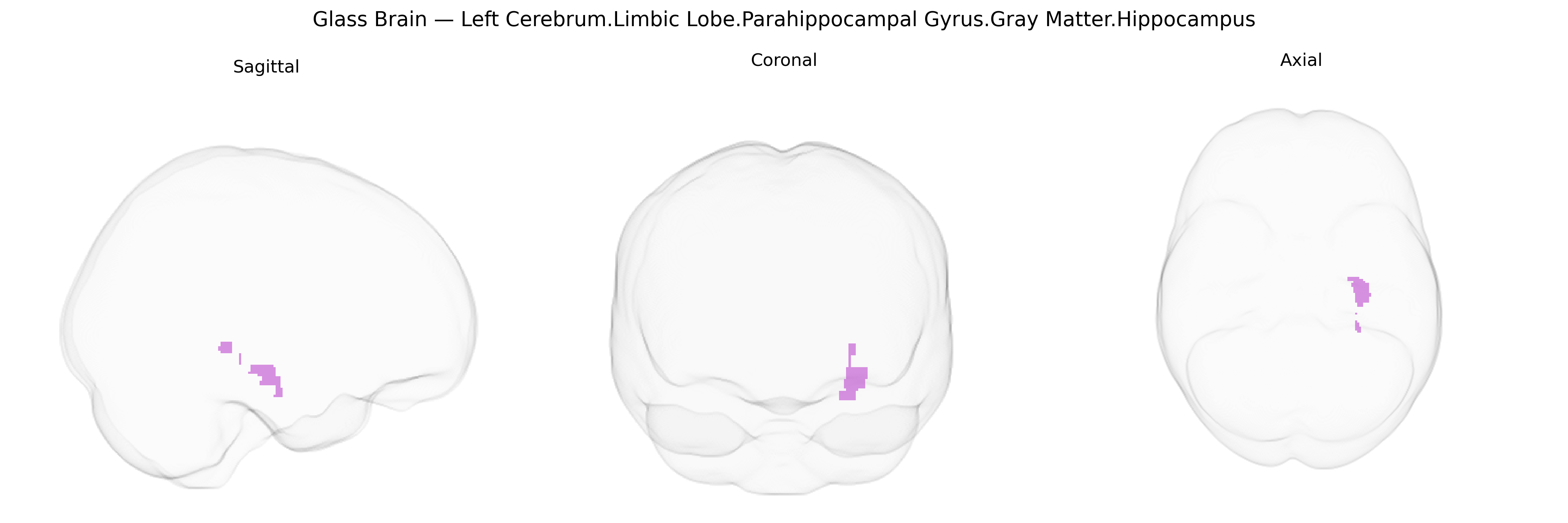 Triplanar Ghost Brain