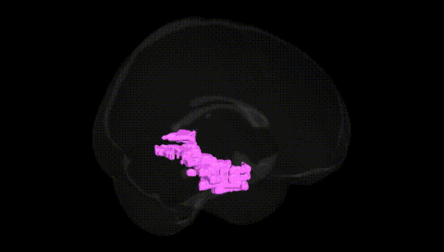 Full Brain Black