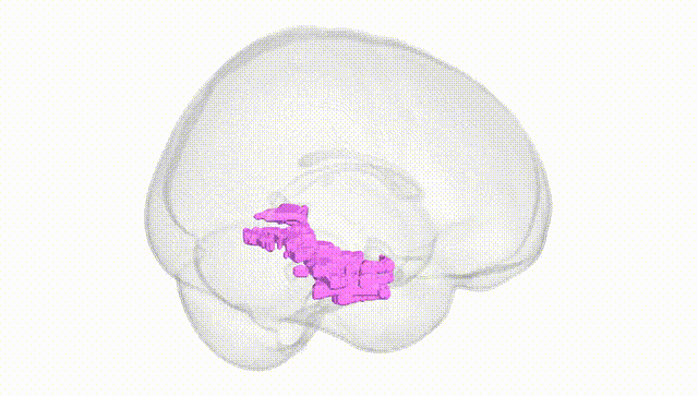 Full Brain White